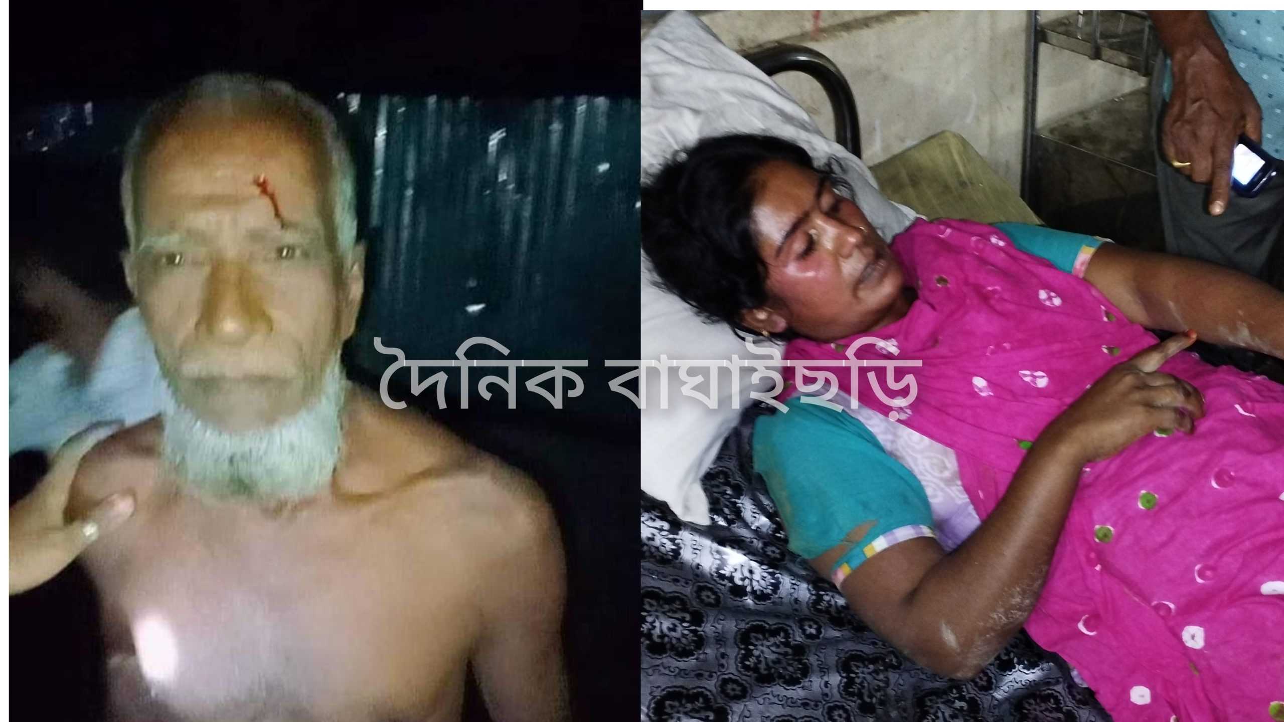 ৬ টি ইট নেয়াকে কেন্দ্র করে হোসেন কাউন্সিলরের নেতৃত্বে বাবা মেয়ে সহ ৪ জনকে পেটানোর অভিযোগ